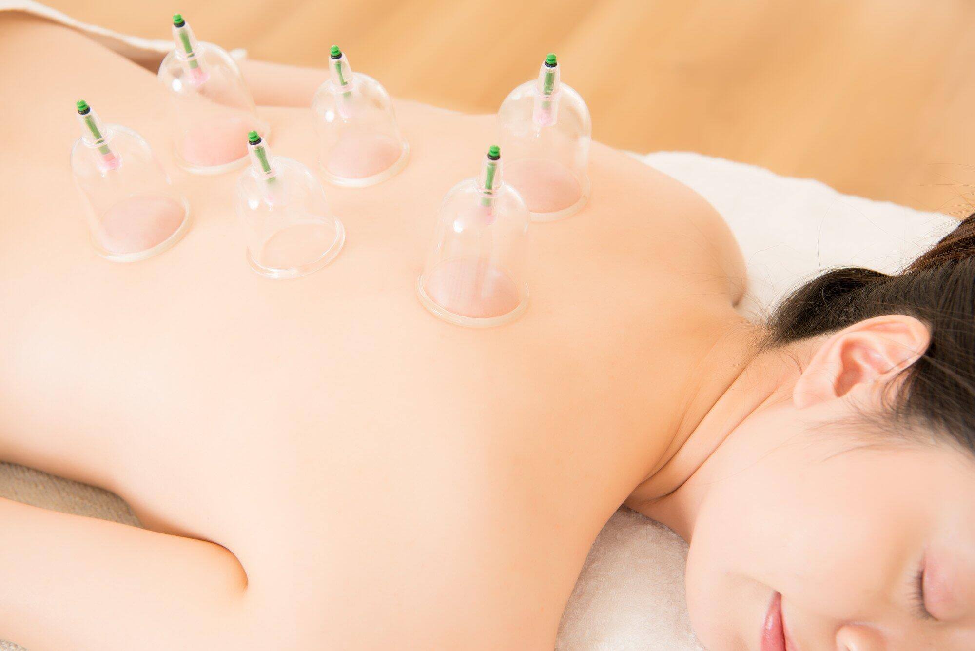 lying on chest with cupping